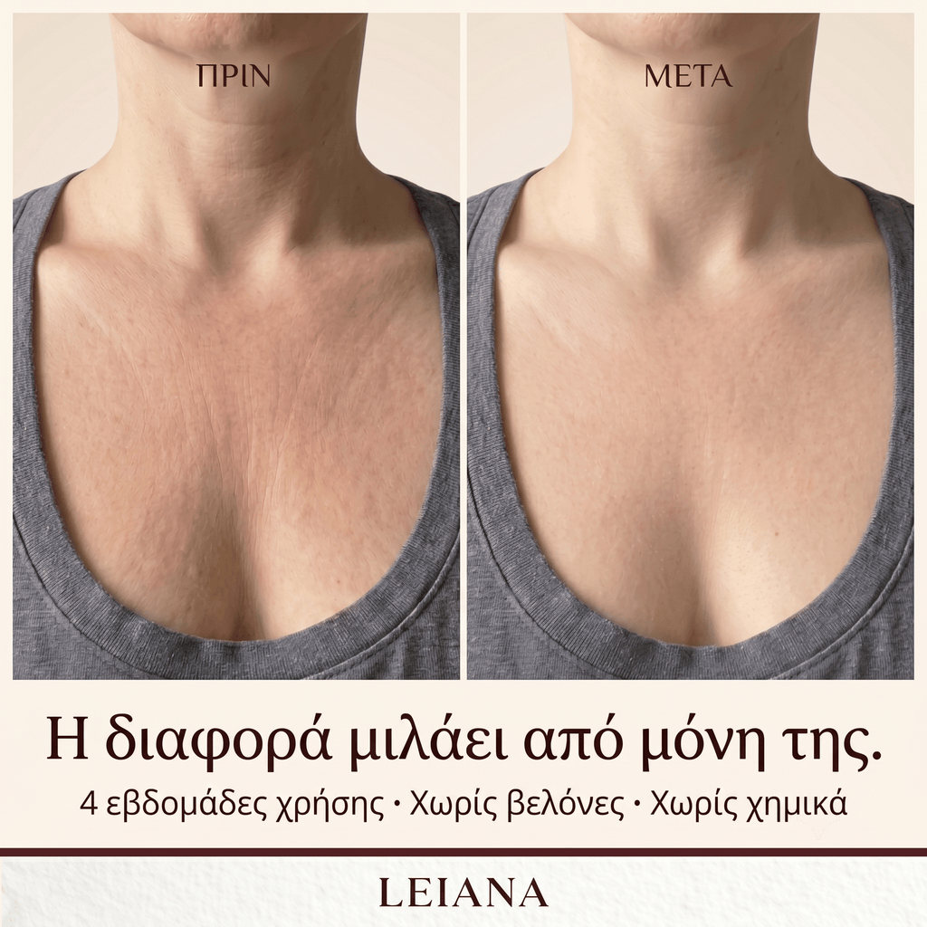 LEIANA Décolletage Patch - Leiana - Leiana