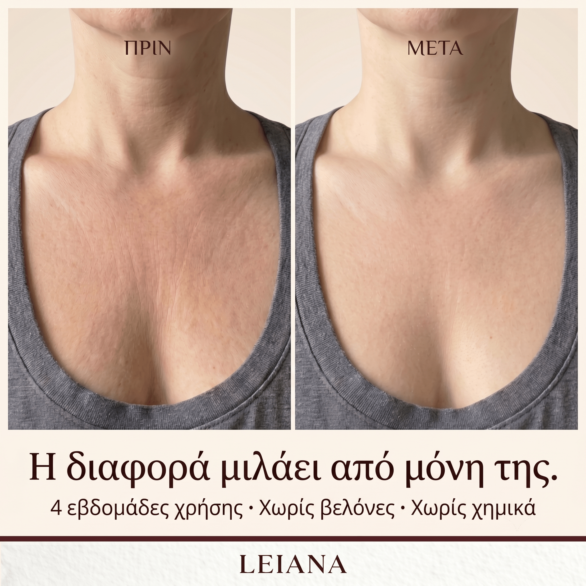 LEIANA Décolletage Patch - Leiana - Leiana