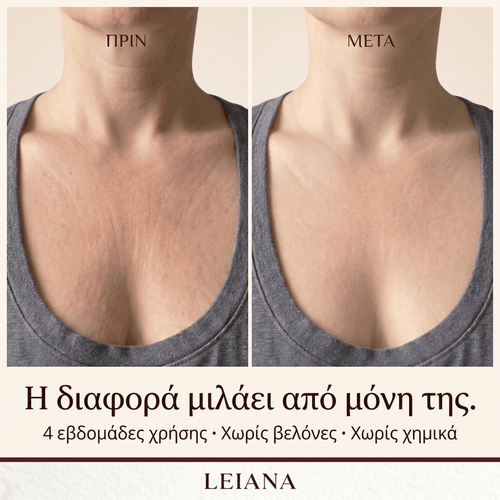 LEIANA Décolletage Patch - Leiana - Leiana